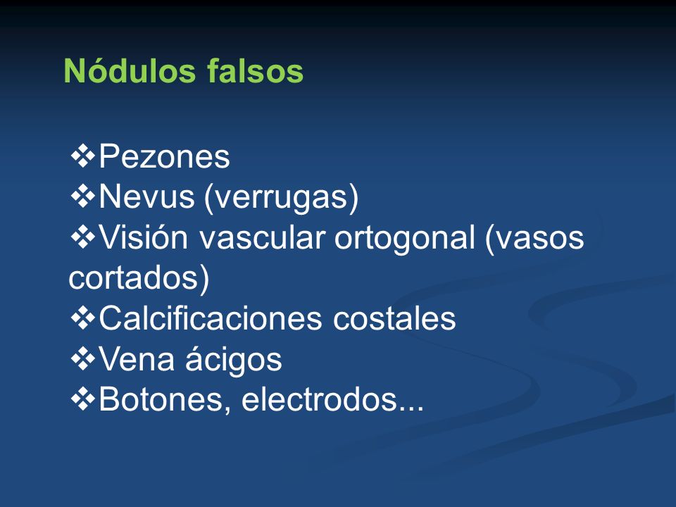 Nódulos falsos Pezones. Nevus (verrugas) Visión vascular ortogonal (vasos cortados) Calcificaciones costales.
