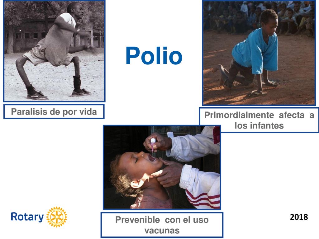 Primordialmente afecta a los infantes Prevenible con el uso vacunas