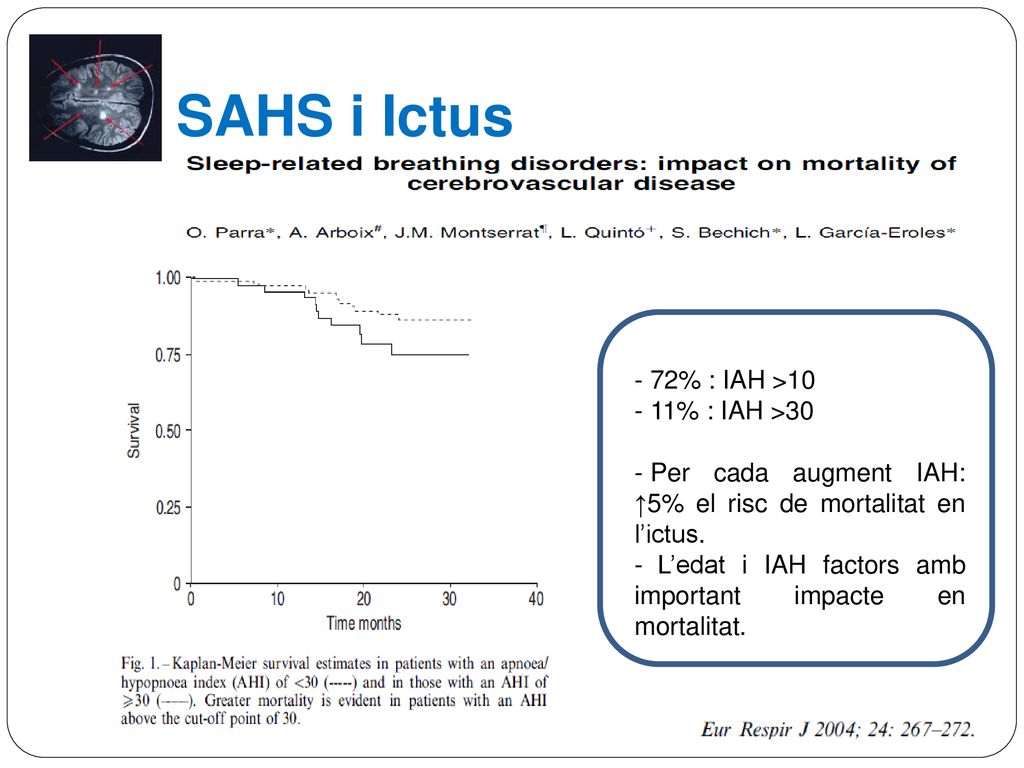 SAHS i Ictus 72% : IAH >10 11% : IAH >30