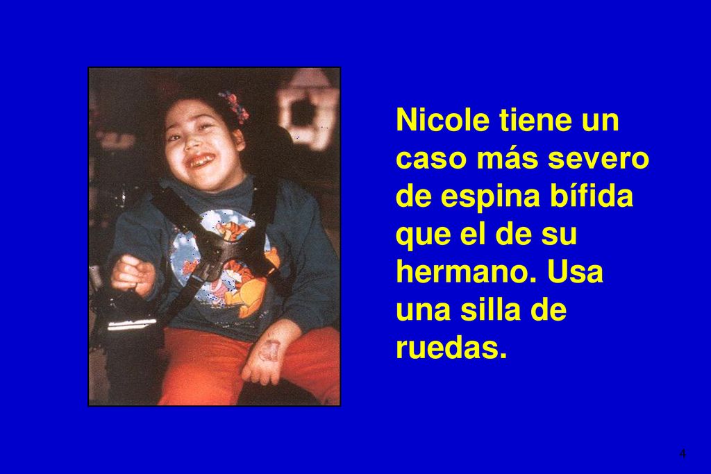 Nicole tiene un caso más severo de espina bífida que el de su hermano