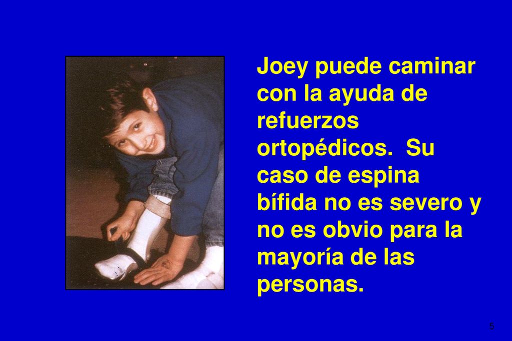 Joey puede caminar con la ayuda de refuerzos ortopédicos