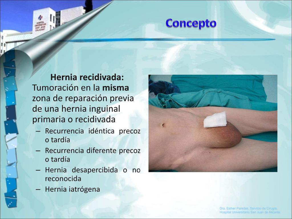 Concepto Hernia recidivada: Tumoración en la misma zona de reparación previa de una hernia inguinal primaria o recidivada.