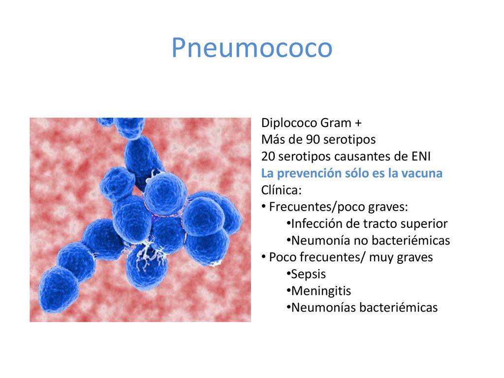 Pneumococo Diplococo Gram + Más de 90 serotipos