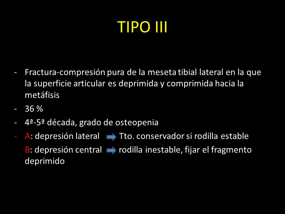 TIPO III Fractura-compresión pura de la meseta tibial lateral en la que la superficie articular es deprimida y comprimida hacia la metáfisis.