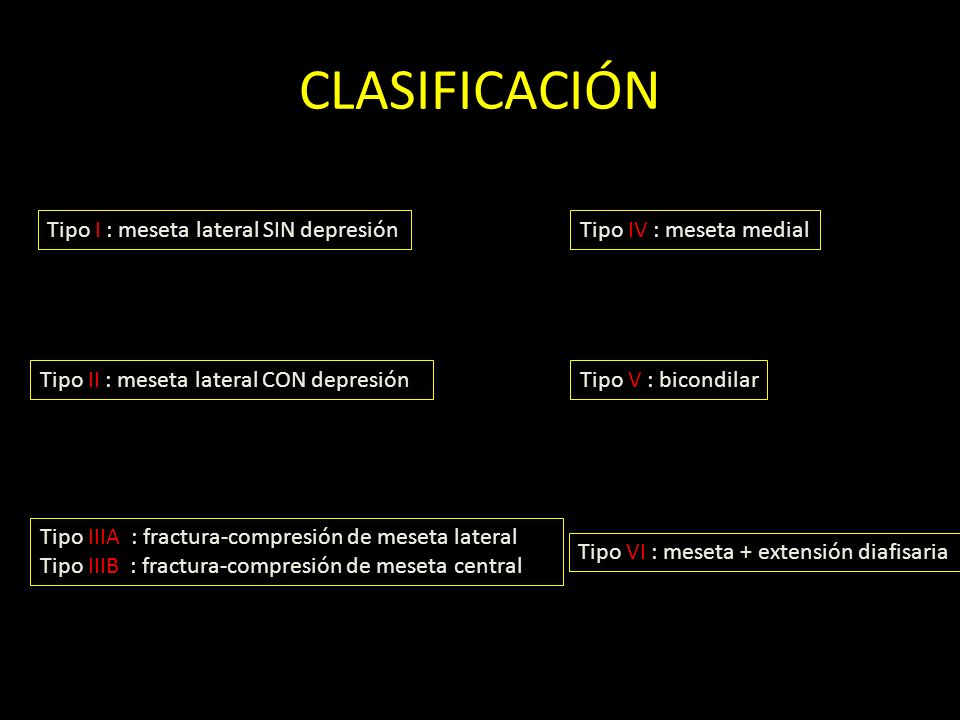 CLASIFICACIÓN Tipo I : meseta lateral SIN depresión