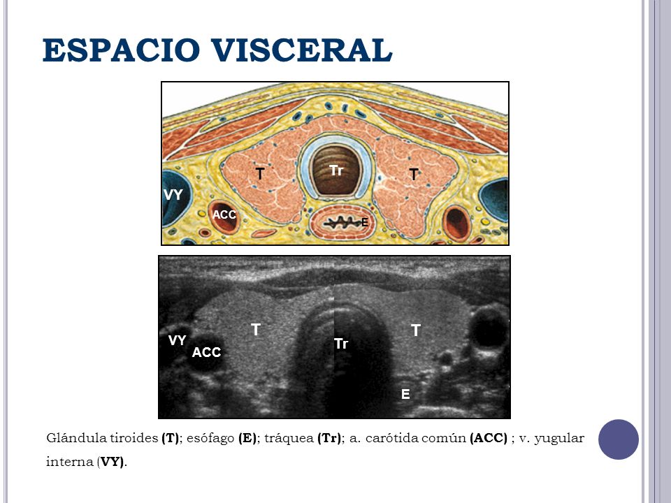 ESPACIO VISCERAL T T T T Tr VY Tr VY ACC E