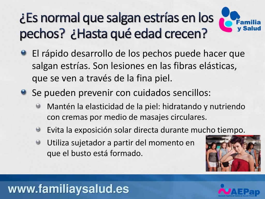 ¿Es normal que salgan estrías en los pechos ¿Hasta qué edad crecen