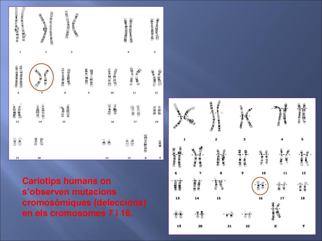 Cariotips humans on s’observen mutacions cromosòmiques (deleccions) en els cromosomes 7 i 16.