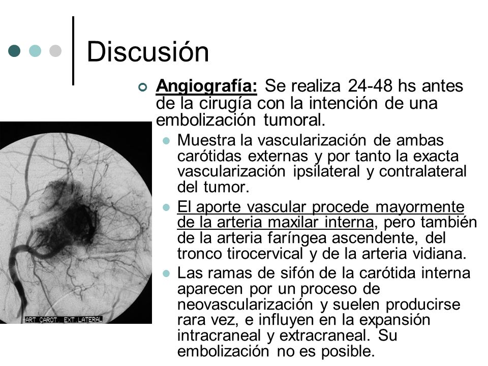 Discusión Angiografía: Se realiza hs antes de la cirugía con la intención de una embolización tumoral.