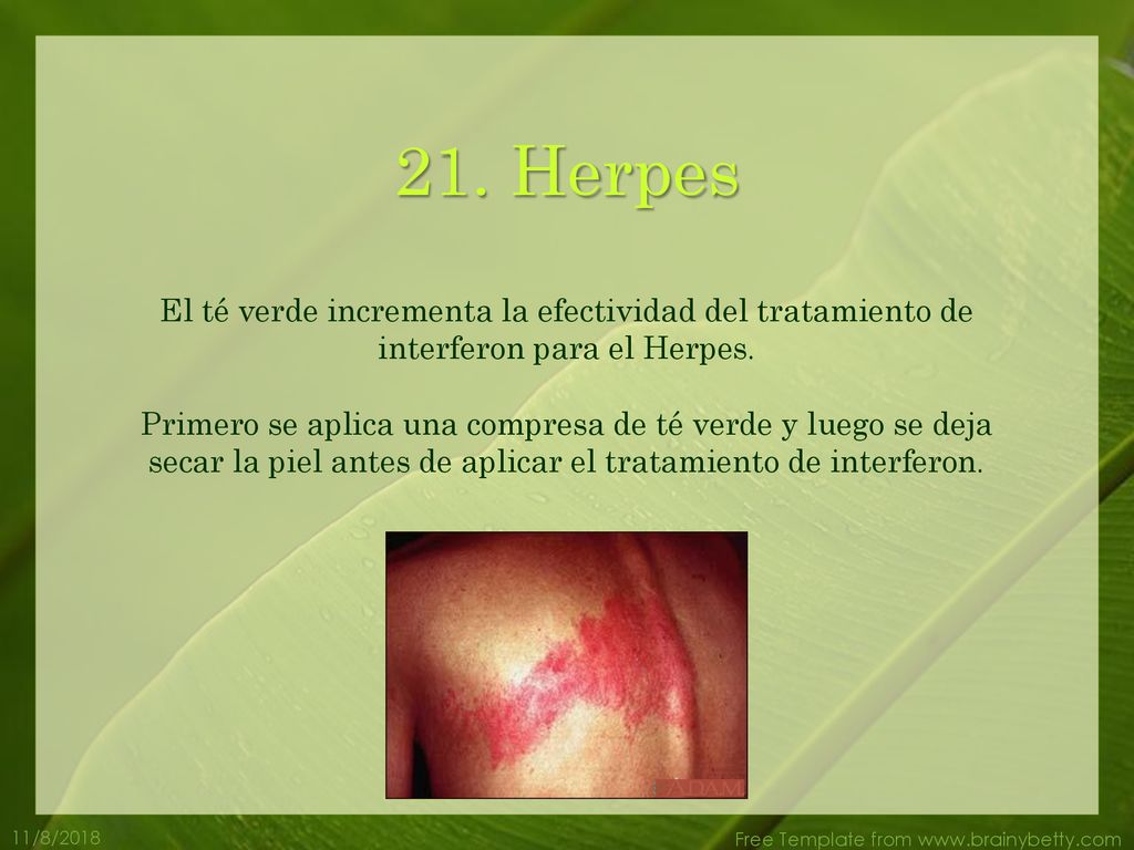 21. Herpes El té verde incrementa la efectividad del tratamiento de interferon para el Herpes.
