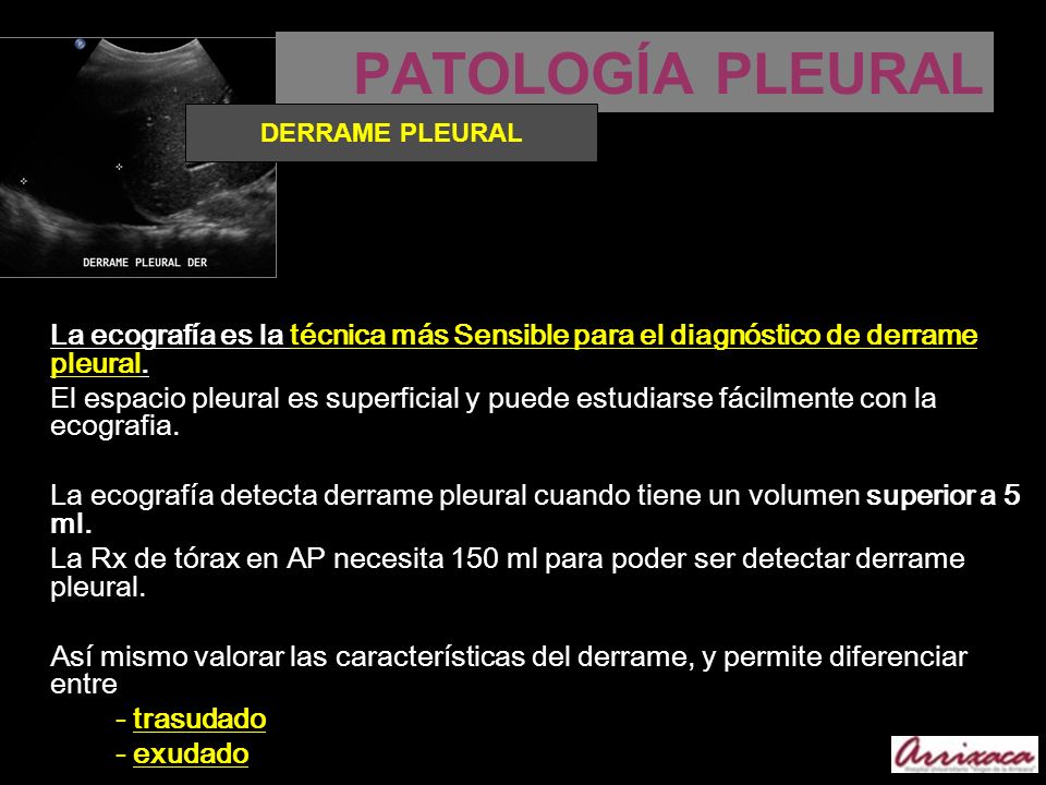 PATOLOGÍA PLEURAL DERRAME PLEURAL. La ecografía es la técnica más Sensible para el diagnóstico de derrame pleural.