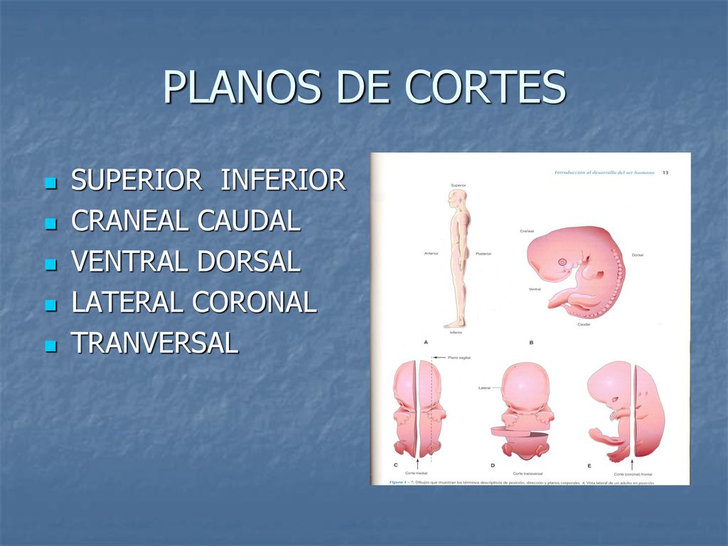 PLANOS DE CORTES SUPERIOR INFERIOR CRANEAL CAUDAL VENTRAL DORSAL