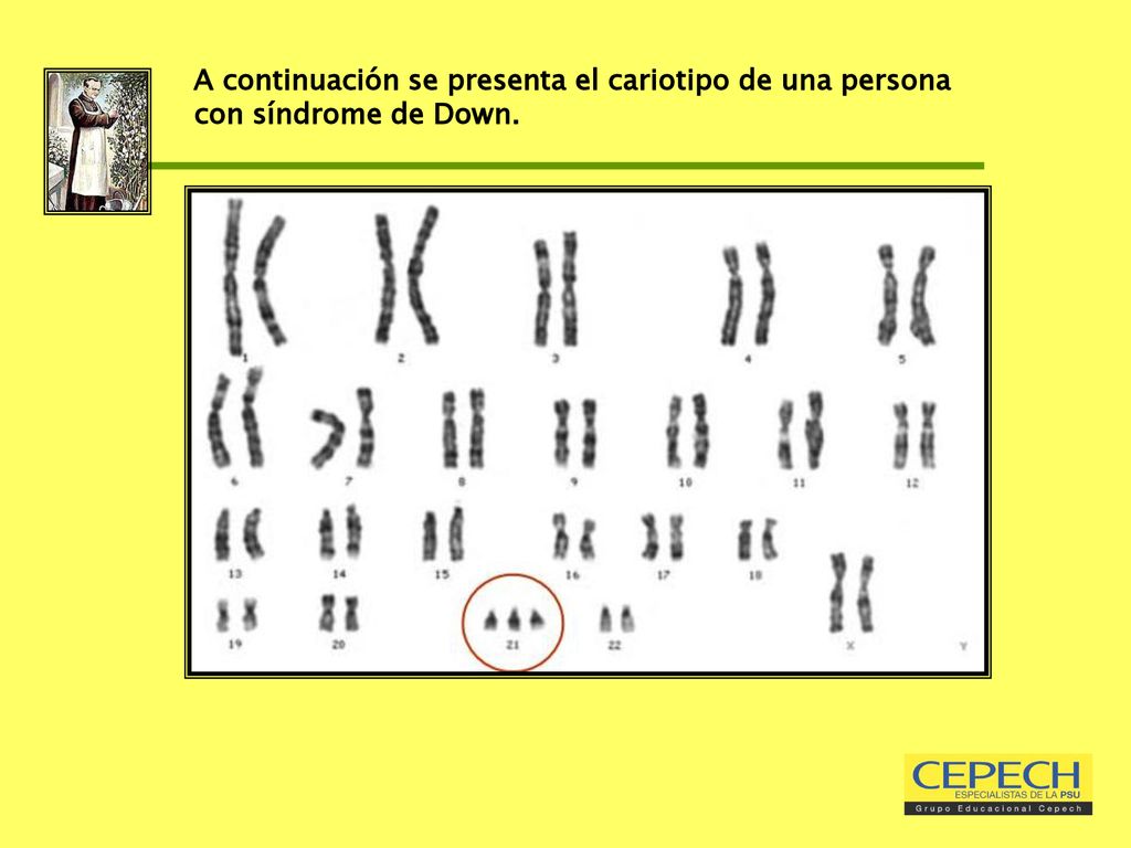 A continuación se presenta el cariotipo de una persona con síndrome de Down.