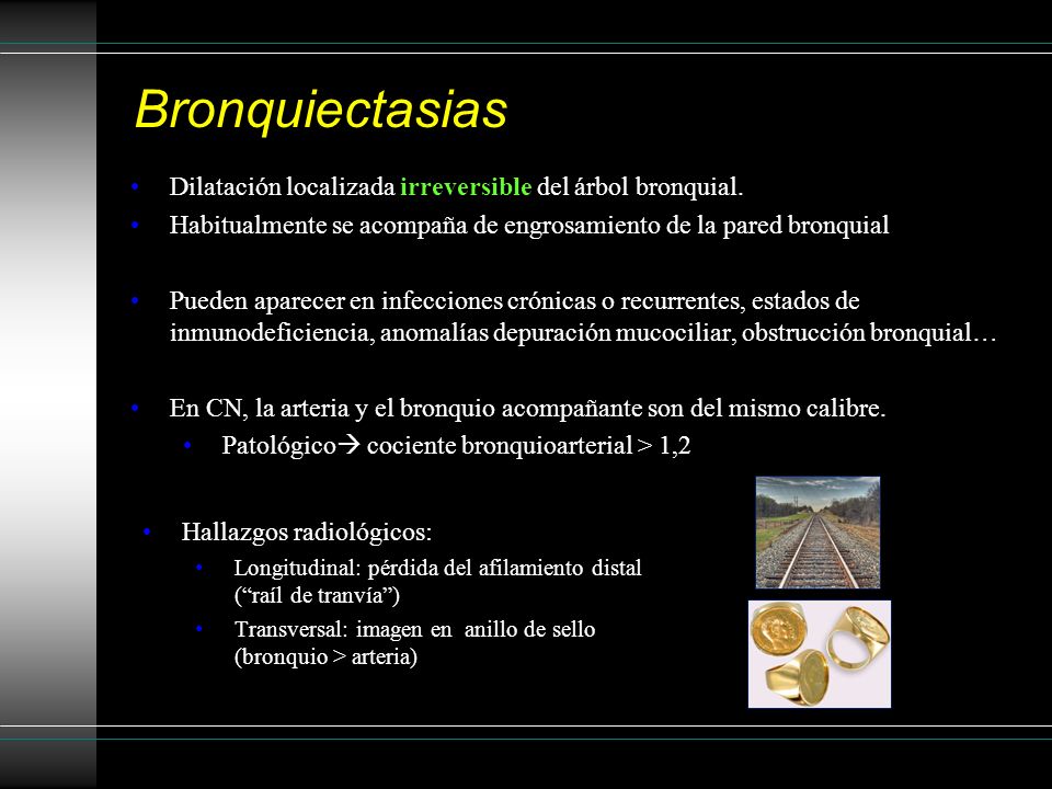 Bronquiectasias Dilatación localizada irreversible del árbol bronquial. Habitualmente se acompaña de engrosamiento de la pared bronquial.
