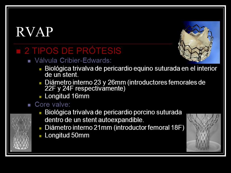 RVAP 2 TIPOS DE PRÓTESIS Válvula Cribier-Edwards: Core valve: