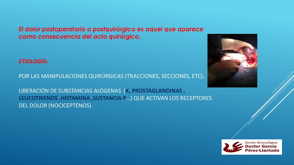 El dolor postoperatorio o postquirúrgico es aquel que aparece como consecuencia del acto quirúrgico.