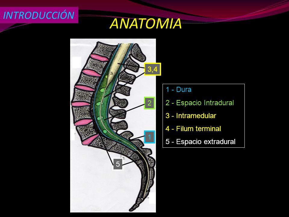 ANATOMIA INTRODUCCIÓN 3,4 1 - Dura 2 - Espacio Intradural