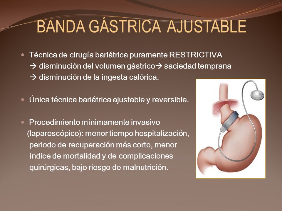 BANDA GÁSTRICA AJUSTABLE
