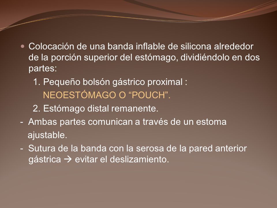 Colocación de una banda inflable de silicona alrededor de la porción superior del estómago, dividiéndolo en dos partes: