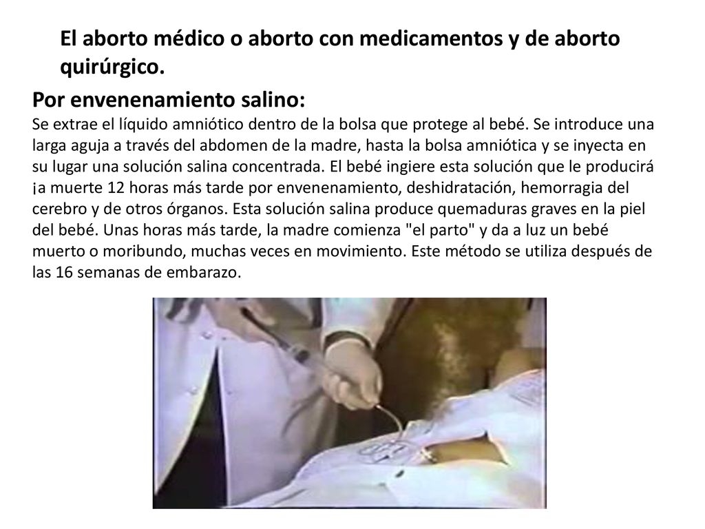 El aborto médico o aborto con medicamentos y de aborto quirúrgico.