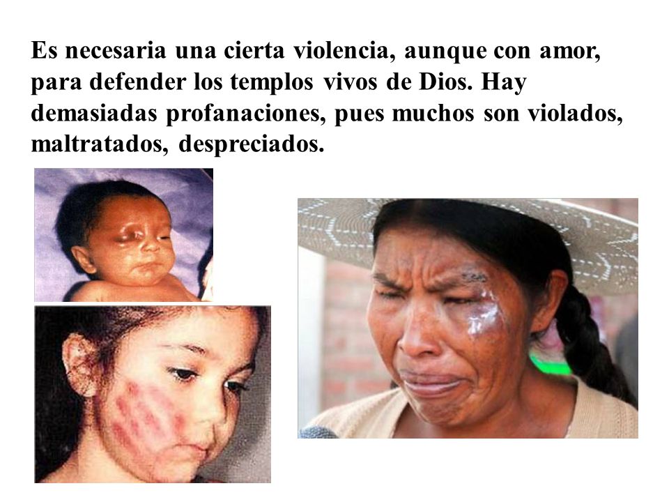 Es necesaria una cierta violencia, aunque con amor, para defender los templos vivos de Dios.