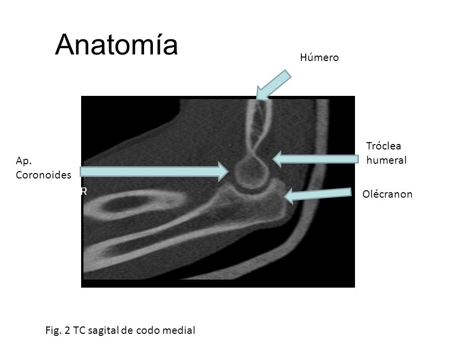 Anatomía Húmero Tróclea humeral Ap. Coronoides Olécranon