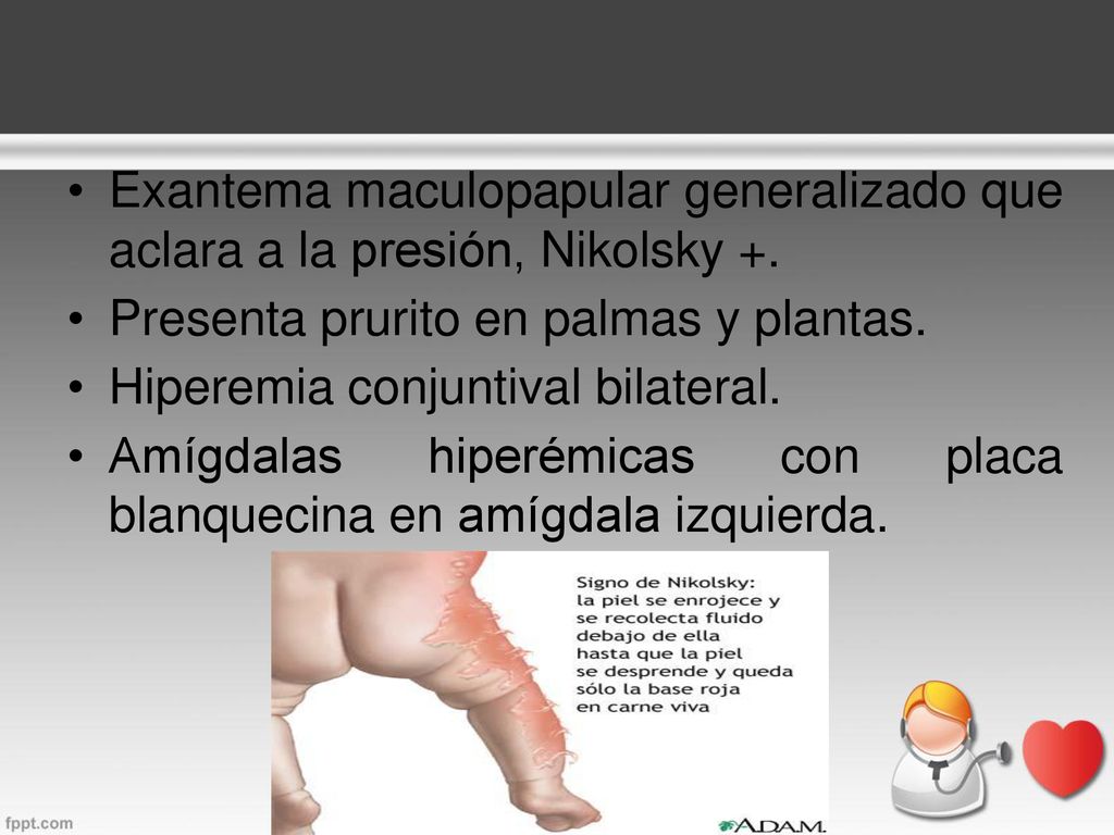 Exantema maculopapular generalizado que aclara a la presión, Nikolsky +.