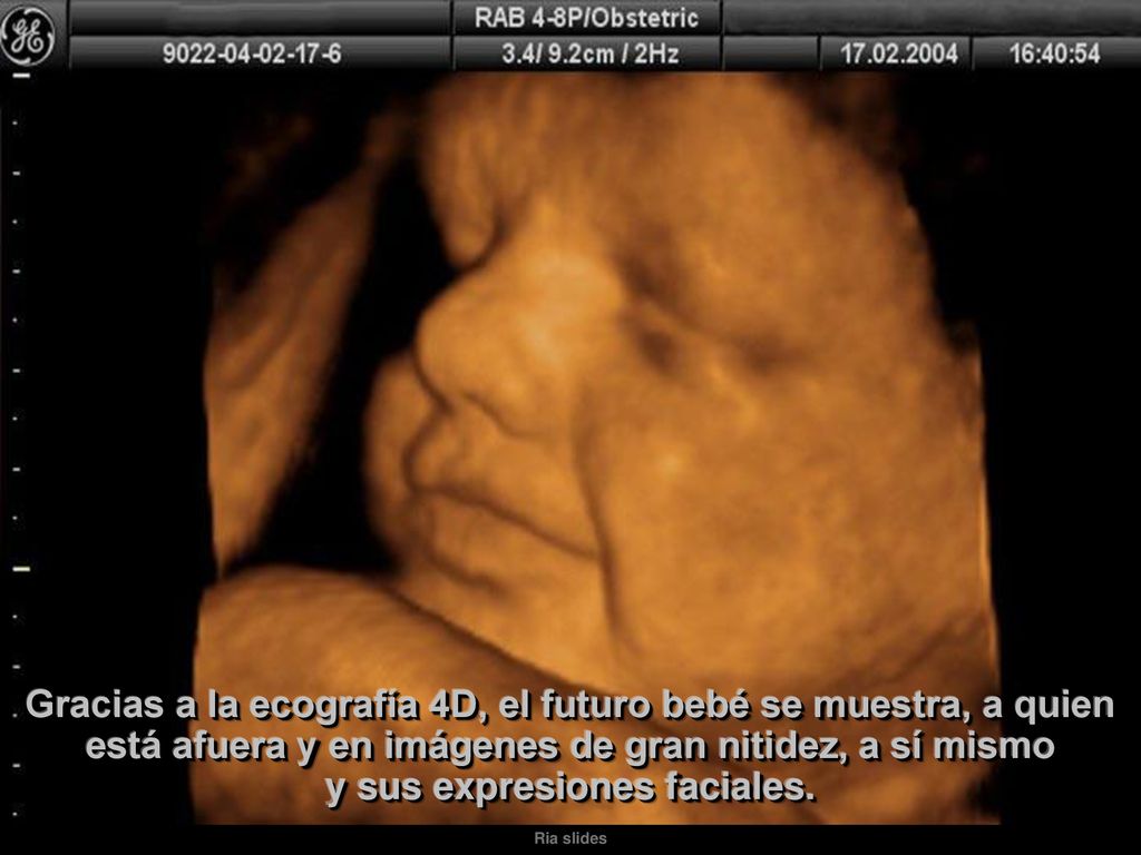 Gracias a la ecografía 4D, el futuro bebé se muestra, a quien está afuera y en imágenes de gran nitidez, a sí mismo y sus expresiones faciales.