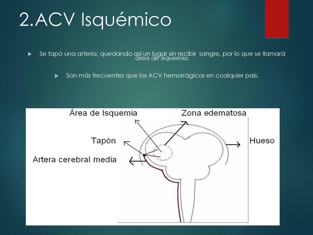 Son más frecuentes que los ACV hemorrágicos en cualquier país.