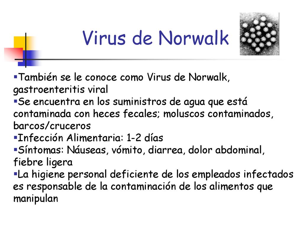 Virus de Norwalk También se le conoce como Virus de Norwalk, gastroenteritis viral.