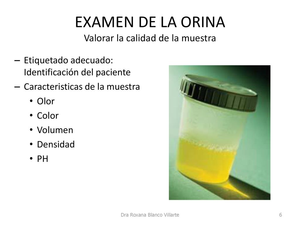 EXAMEN DE LA ORINA Valorar la calidad de la muestra