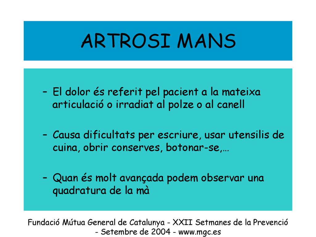 ARTROSI MANS El dolor és referit pel pacient a la mateixa articulació o irradiat al polze o al canell.