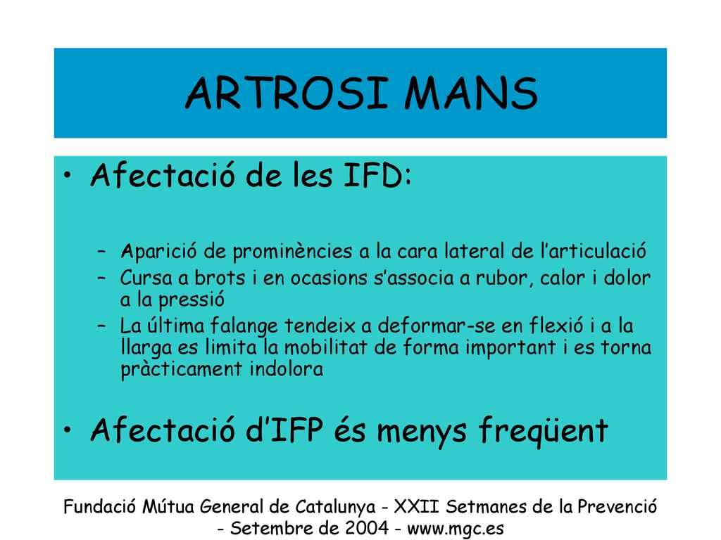 ARTROSI MANS Afectació de les IFD: Afectació d’IFP és menys freqüent