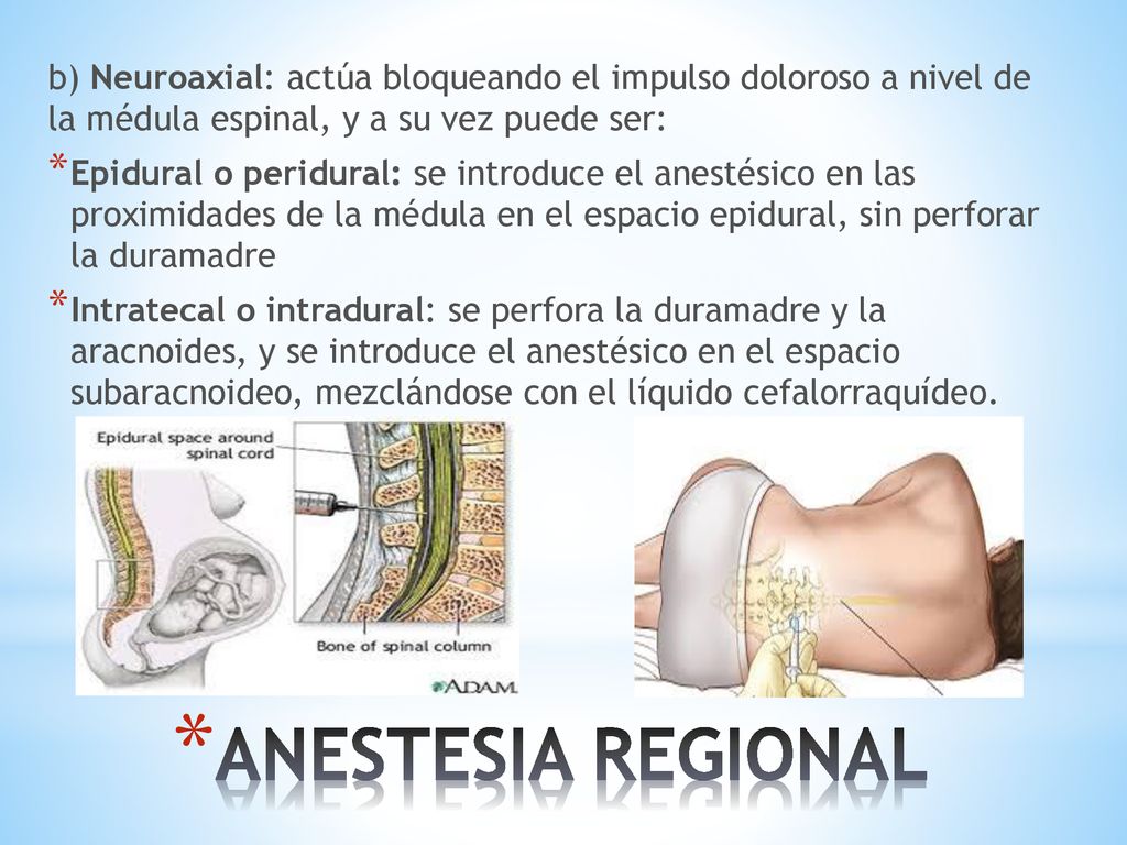b) Neuroaxial: actúa bloqueando el impulso doloroso a nivel de la médula espinal, y a su vez puede ser: