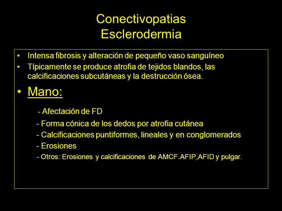 Conectivopatias Esclerodermia