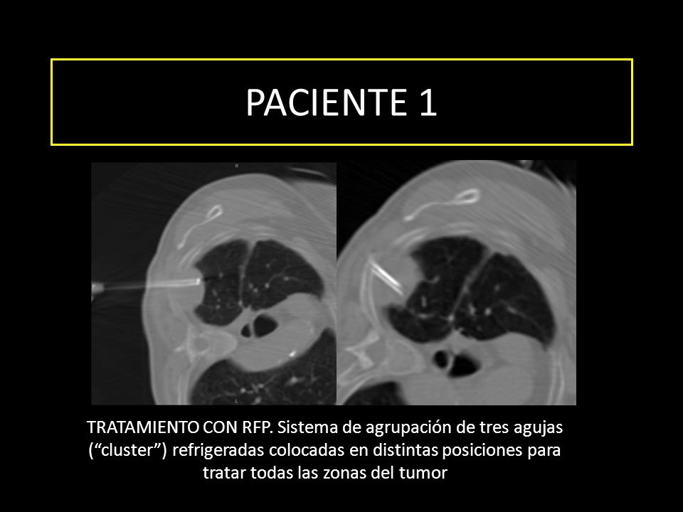 PACIENTE 1