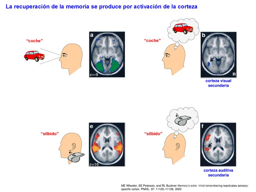 corteza visual secundaria corteza auditiva secundaria