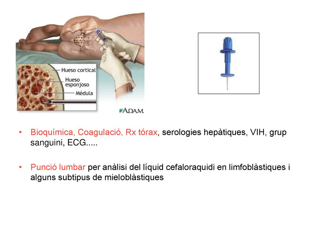 Bioquímica, Coagulació, Rx tórax, serologies hepàtiques, VIH, grup sanguini, ECG.....