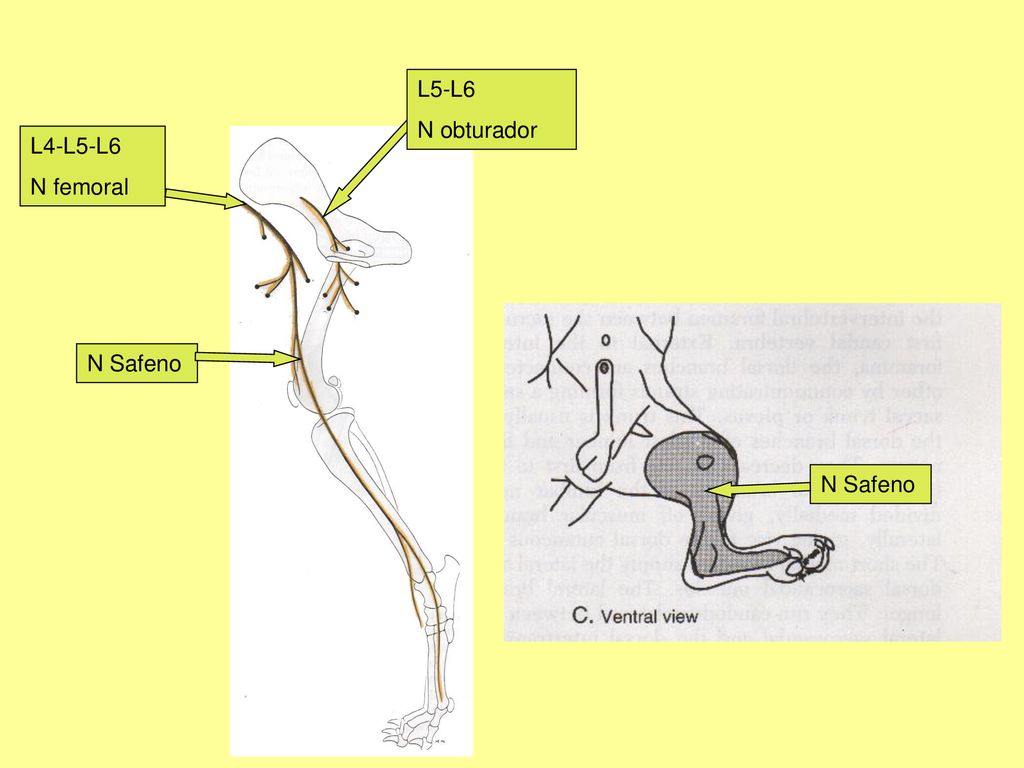 L5-L6 N obturador L4-L5-L6 N femoral N Safeno N Safeno