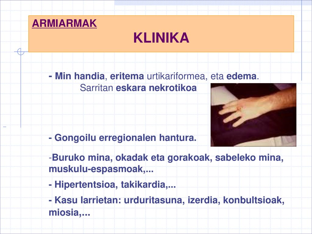 KLINIKA ARMIARMAK - Min handia, eritema urtikariformea, eta edema.