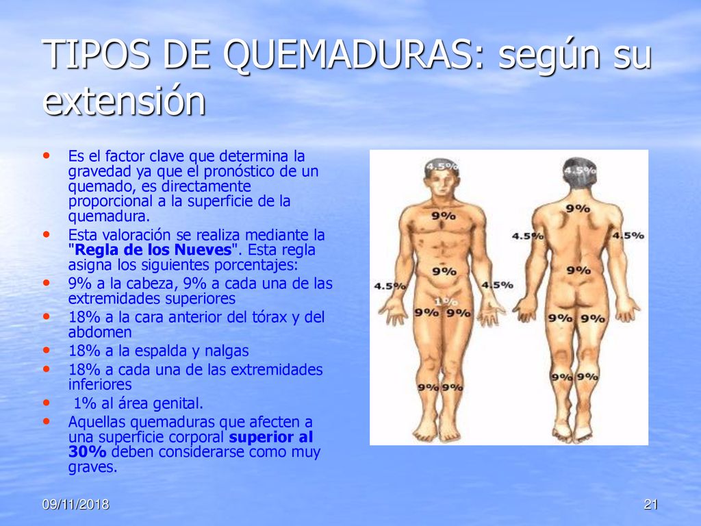 TIPOS DE QUEMADURAS: según su extensión