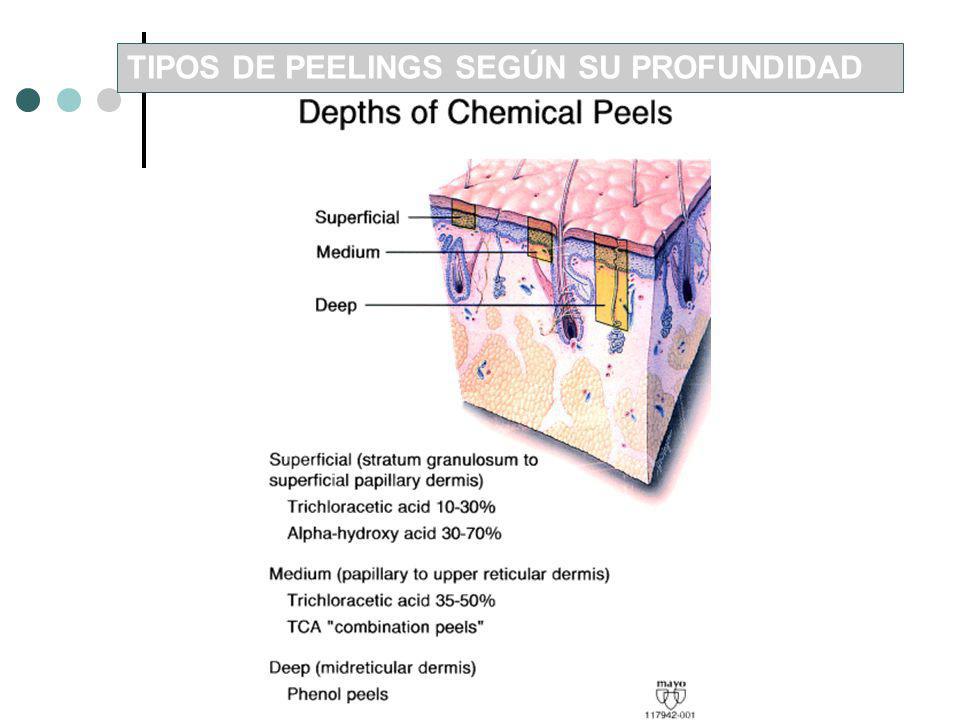 TIPOS DE PEELINGS SEGÚN SU PROFUNDIDAD