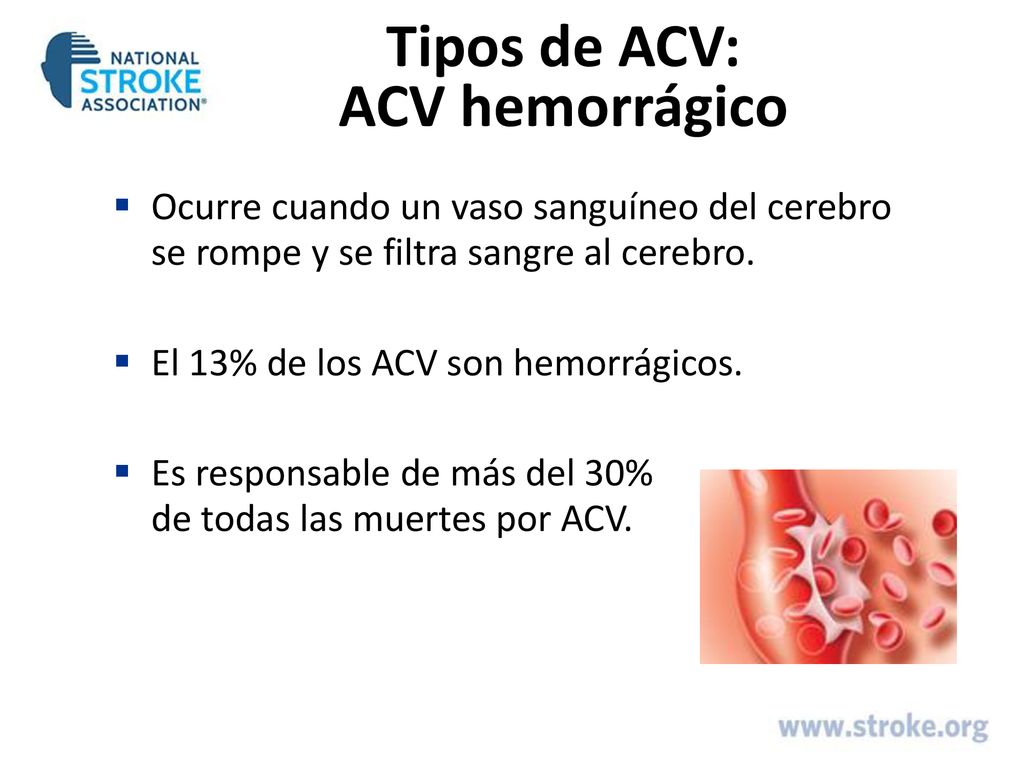 Tipos de ACV: ACV hemorrágico