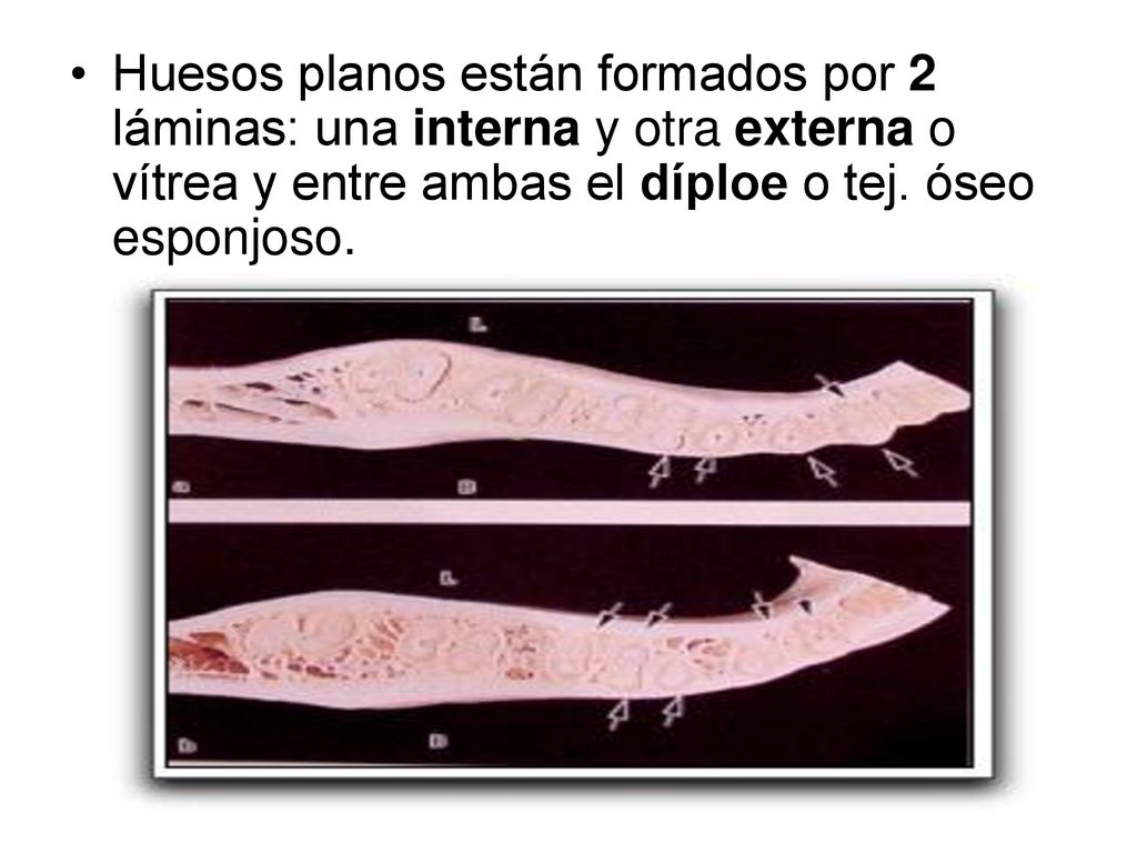 Huesos planos están formados por 2 láminas: una interna y otra externa o vítrea y entre ambas el díploe o tej.