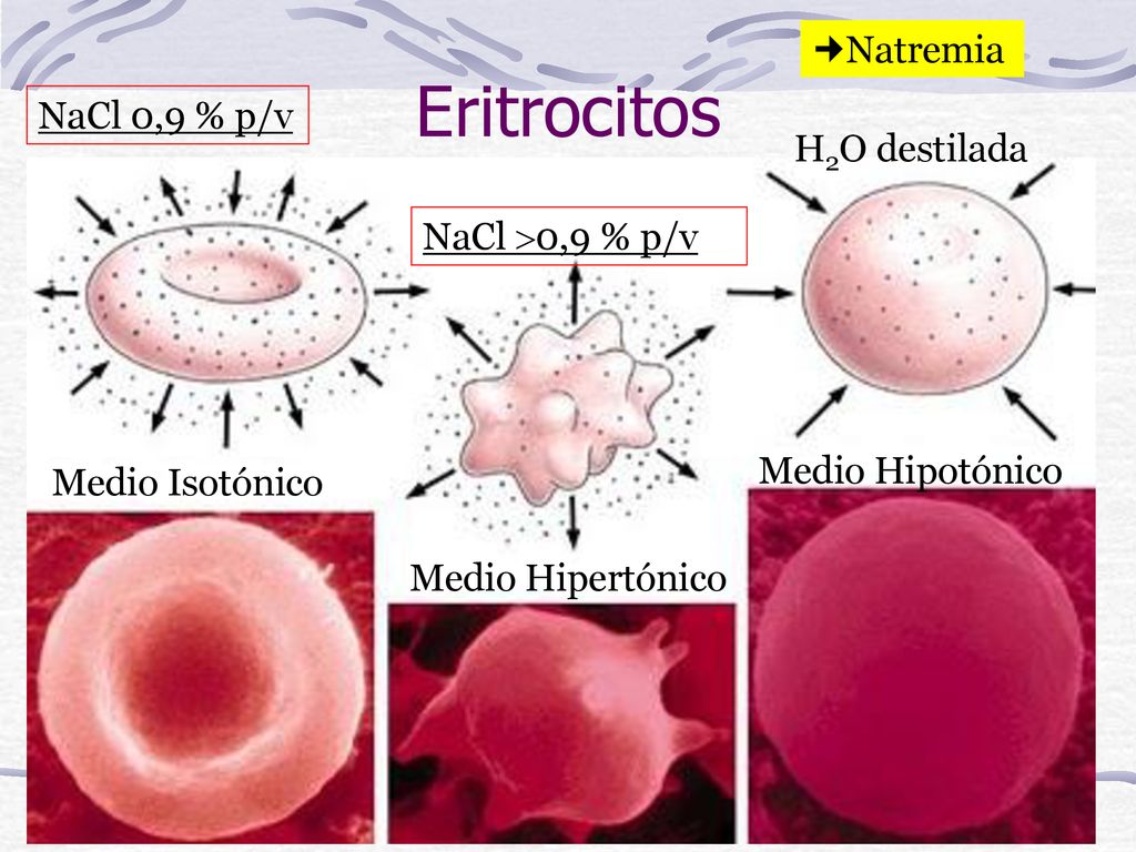 Eritrocitos Natremia NaCl 0,9 % p/v H2O destilada NaCl 0,9 % p/v