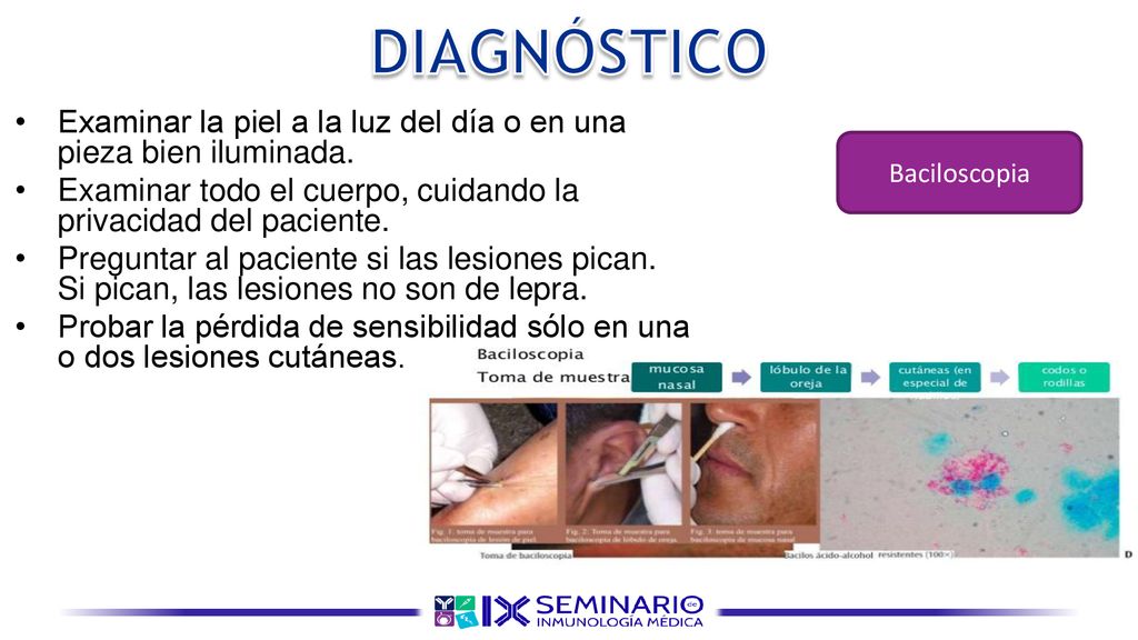 DIAGNÓSTICO Examinar la piel a la luz del día o en una pieza bien iluminada. Examinar todo el cuerpo, cuidando la privacidad del paciente.