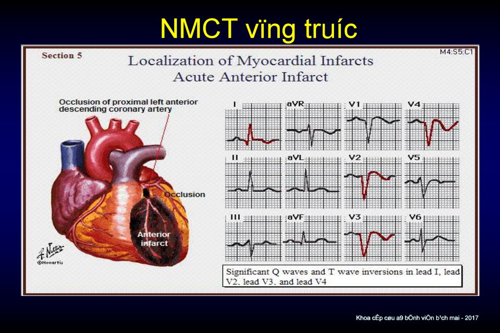 NMCT vïng tru­íc Khoa cÊp cøu a9 bÖnh viÖn b¹ch mai