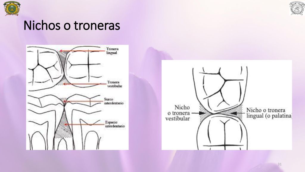Nichos o troneras La tronera bucal esta ubicada del punto de contacto hacia la cara de mismo nombre.