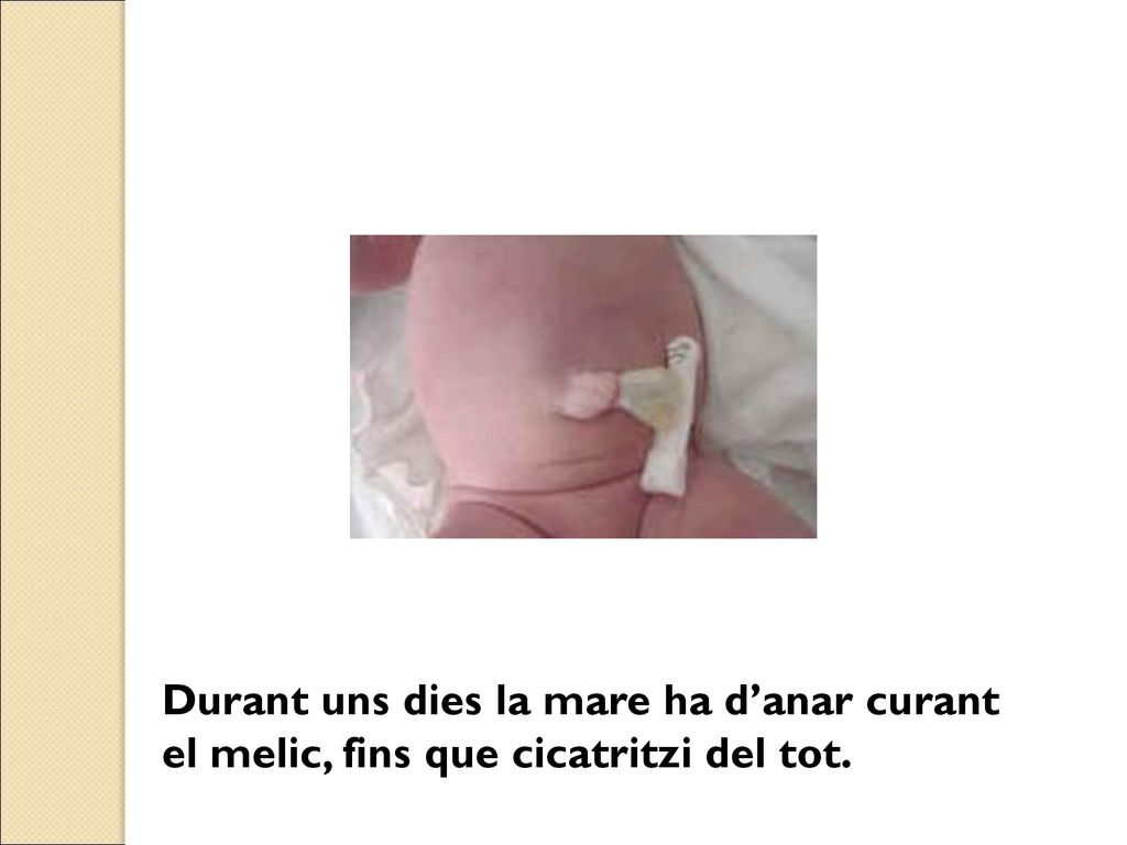 Durant uns dies la mare ha d’anar curant el melic, fins que cicatritzi del tot.