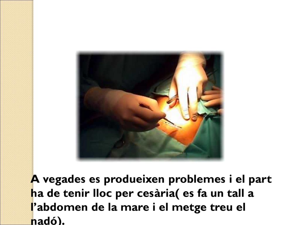 A vegades es produeixen problemes i el part ha de tenir lloc per cesària( es fa un tall a l’abdomen de la mare i el metge treu el nadó).
